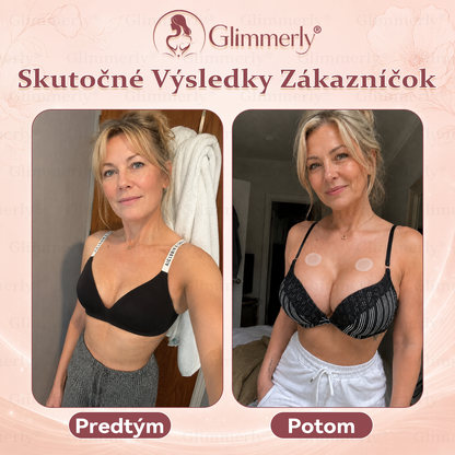 🍀📛⏰𝐆𝐥𝐢𝐦𝐦𝐞𝐫𝐥𝐲® 𝑍𝑣äčš𝑒𝑛𝑖𝑒 𝑂𝑏𝑗𝑒𝑚𝑢 𝐴 𝑆𝑝𝑒𝑣𝑛𝑒𝑛𝑖𝑒 𝑃ŕ𝑠 & 𝑀𝑖𝑘𝑟𝑜𝑖ℎ𝑙𝑖č𝑘𝑜𝑣é 𝑁á𝑝𝑙𝑎𝑠𝑡𝑖