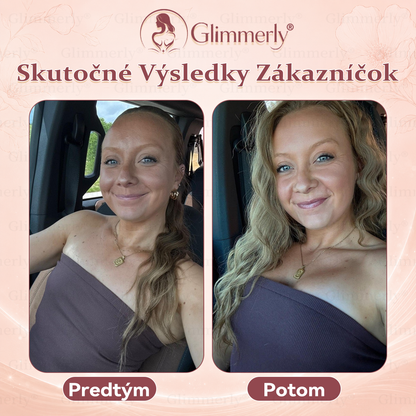 🍀📛⏰𝐆𝐥𝐢𝐦𝐦𝐞𝐫𝐥𝐲® 𝑍𝑣äčš𝑒𝑛𝑖𝑒 𝑂𝑏𝑗𝑒𝑚𝑢 𝐴 𝑆𝑝𝑒𝑣𝑛𝑒𝑛𝑖𝑒 𝑃ŕ𝑠 & 𝑀𝑖𝑘𝑟𝑜𝑖ℎ𝑙𝑖č𝑘𝑜𝑣é 𝑁á𝑝𝑙𝑎𝑠𝑡𝑖