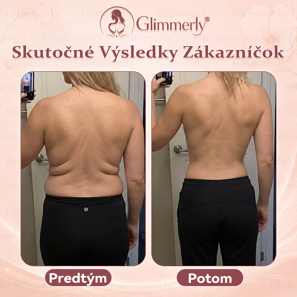 🍀📛⏰𝐆𝐥𝐢𝐦𝐦𝐞𝐫𝐥𝐲® 𝑍𝑣äčš𝑒𝑛𝑖𝑒 𝑂𝑏𝑗𝑒𝑚𝑢 𝐴 𝑆𝑝𝑒𝑣𝑛𝑒𝑛𝑖𝑒 𝑃ŕ𝑠 & 𝑀𝑖𝑘𝑟𝑜𝑖ℎ𝑙𝑖č𝑘𝑜𝑣é 𝑁á𝑝𝑙𝑎𝑠𝑡𝑖