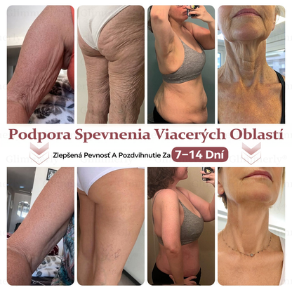 🍀📛⏰𝐆𝐥𝐢𝐦𝐦𝐞𝐫𝐥𝐲® 𝑍𝑣äčš𝑒𝑛𝑖𝑒 𝑂𝑏𝑗𝑒𝑚𝑢 𝐴 𝑆𝑝𝑒𝑣𝑛𝑒𝑛𝑖𝑒 𝑃ŕ𝑠 & 𝑀𝑖𝑘𝑟𝑜𝑖ℎ𝑙𝑖č𝑘𝑜𝑣é 𝑁á𝑝𝑙𝑎𝑠𝑡𝑖