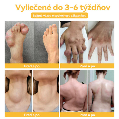 🐝👩‍🔬𝐅𝐥𝐨𝐫𝐢𝐬𝐦𝐚®𝐕č𝐞𝐥í 𝐉𝐞𝐝 𝐀 𝐊𝐮𝐫𝐤𝐮𝐦𝐚 𝐊𝐫é𝐦 𝐍𝐚 𝐓𝐞𝐫𝐚𝐩𝐢𝐮 𝐀𝐫𝐭𝐫𝐢𝐭í𝐝𝐲🐝(𝐎𝐛𝐳𝐯𝐥ášť 𝐯𝐡𝐨𝐝𝐧é 𝐩𝐫𝐞 𝐬𝐭𝐚𝐫ší𝐜𝐡 ľ𝐮𝐝í)