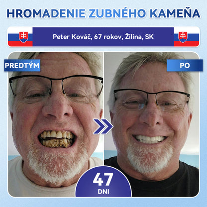 🦷𝐆𝐥𝐢𝐦𝐦𝐞𝐫𝐥𝐲® 𝐓𝐢𝐝𝐞𝐠𝐥𝐮𝐬𝐢𝐛 𝐙𝐮𝐛𝐲 𝐀 Ď𝐚𝐬𝐧á 𝐎𝐩𝐫𝐚𝐯𝐧á 𝐌𝐢𝐤𝐫𝐨𝐢𝐡𝐥𝐨𝐯á 𝐍á𝐩𝐥𝐚𝐬ť  |🌟🪥 𝐏𝐨𝐤𝐫𝐨č𝐢𝐥é 𝐩á𝐬𝐢𝐤𝐲 𝐧𝐚 𝐚𝐤𝐭𝐢𝐯á𝐜𝐢𝐮 𝐤𝐦𝐞ň𝐨𝐯ý𝐜𝐡 𝐛𝐮𝐧𝐢𝐞𝐤 𝐳𝐮𝐛𝐨𝐯(🦷𝐎𝐛𝐧𝐨𝐯𝐮𝐣𝐞 𝐙𝐮𝐛𝐧ú 𝐒𝐤𝐥𝐨𝐯𝐢𝐧𝐮 𝐀 𝐃𝐞𝐧𝐭í𝐧 • 𝐏𝐨𝐬𝐢𝐥ň𝐮𝐣𝐞 Ď𝐚𝐬𝐧á • 𝐎𝐝𝐬𝐭𝐫𝐚ň𝐮𝐣𝐞 𝐙𝐮𝐛𝐧ý 𝐊𝐚𝐦𝐞ň 𝐀 𝐙á𝐩𝐚𝐜𝐡 • 𝐙𝐚𝐬𝐭𝐚𝐯𝐮𝐣𝐞 𝐂𝐢𝐭𝐥𝐢𝐯𝐨𝐬ť 𝐙𝐮𝐛𝐨𝐯) (Copy)