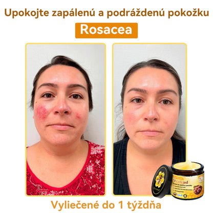 [💯 Bez bolesti-bez vedľajších účinkov] 𝐃𝐨𝐫𝐦𝐨𝐫𝐧𝐚®💥💥𝐕č𝐞𝐥í 𝐣𝐞𝐝 𝐊𝐫é𝐦 𝐧𝐚 𝐨𝐛𝐧𝐨𝐯𝐮 𝐩𝐨𝐤𝐨ž𝐤𝐲- POSLEDNÝ DEŇ 70% VYPNUTIE