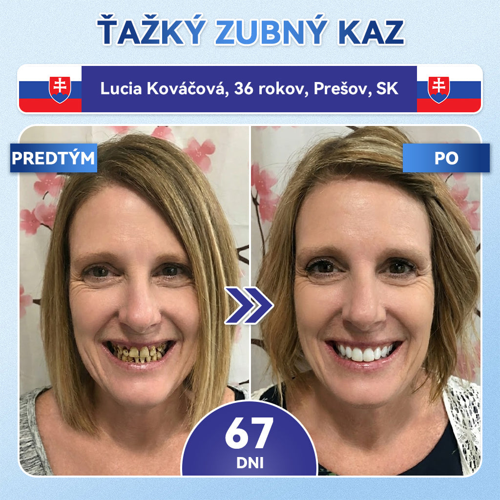 🦷𝐆𝐥𝐢𝐦𝐦𝐞𝐫𝐥𝐲® 𝐓𝐢𝐝𝐞𝐠𝐥𝐮𝐬𝐢𝐛 𝐙𝐮𝐛𝐲 𝐀 Ď𝐚𝐬𝐧á 𝐎𝐩𝐫𝐚𝐯𝐧á 𝐌𝐢𝐤𝐫𝐨𝐢𝐡𝐥𝐨𝐯á 𝐍á𝐩𝐥𝐚𝐬ť  |🌟🪥 𝐏𝐨𝐤𝐫𝐨č𝐢𝐥é 𝐩á𝐬𝐢𝐤𝐲 𝐧𝐚 𝐚𝐤𝐭𝐢𝐯á𝐜𝐢𝐮 𝐤𝐦𝐞ň𝐨𝐯ý𝐜𝐡 𝐛𝐮𝐧𝐢𝐞𝐤 𝐳𝐮𝐛𝐨𝐯(🦷𝐎𝐛𝐧𝐨𝐯𝐮𝐣𝐞 𝐙𝐮𝐛𝐧ú 𝐒𝐤𝐥𝐨𝐯𝐢𝐧𝐮 𝐀 𝐃𝐞𝐧𝐭í𝐧 • 𝐏𝐨𝐬𝐢𝐥ň𝐮𝐣𝐞 Ď𝐚𝐬𝐧á • 𝐎𝐝𝐬𝐭𝐫𝐚ň𝐮𝐣𝐞 𝐙𝐮𝐛𝐧ý 𝐊𝐚𝐦𝐞ň 𝐀 𝐙á𝐩𝐚𝐜𝐡 • 𝐙𝐚𝐬𝐭𝐚𝐯𝐮𝐣𝐞 𝐂𝐢𝐭𝐥𝐢𝐯𝐨𝐬ť 𝐙𝐮𝐛𝐨𝐯) (Copy)