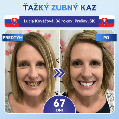 🦷𝐆𝐥𝐢𝐦𝐦𝐞𝐫𝐥𝐲® 𝐓𝐢𝐝𝐞𝐠𝐥𝐮𝐬𝐢𝐛 𝐙𝐮𝐛𝐲 𝐀 Ď𝐚𝐬𝐧á 𝐎𝐩𝐫𝐚𝐯𝐧á 𝐌𝐢𝐤𝐫𝐨𝐢𝐡𝐥𝐨𝐯á 𝐍á𝐩𝐥𝐚𝐬ť  |🌟🪥 𝐏𝐨𝐤𝐫𝐨č𝐢𝐥é 𝐩á𝐬𝐢𝐤𝐲 𝐧𝐚 𝐚𝐤𝐭𝐢𝐯á𝐜𝐢𝐮 𝐤𝐦𝐞ň𝐨𝐯ý𝐜𝐡 𝐛𝐮𝐧𝐢𝐞𝐤 𝐳𝐮𝐛𝐨𝐯(🦷𝐎𝐛𝐧𝐨𝐯𝐮𝐣𝐞 𝐙𝐮𝐛𝐧ú 𝐒𝐤𝐥𝐨𝐯𝐢𝐧𝐮 𝐀 𝐃𝐞𝐧𝐭í𝐧 • 𝐏𝐨𝐬𝐢𝐥ň𝐮𝐣𝐞 Ď𝐚𝐬𝐧á • 𝐎𝐝𝐬𝐭𝐫𝐚ň𝐮𝐣𝐞 𝐙𝐮𝐛𝐧ý 𝐊𝐚𝐦𝐞ň 𝐀 𝐙á𝐩𝐚𝐜𝐡 • 𝐙𝐚𝐬𝐭𝐚𝐯𝐮𝐣𝐞 𝐂𝐢𝐭𝐥𝐢𝐯𝐨𝐬ť 𝐙𝐮𝐛𝐨𝐯) (Copy)