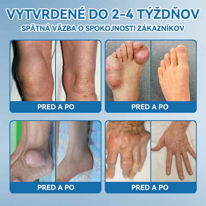 𝐎𝐟𝐢𝐜𝐢á𝐥𝐧𝐲 𝐨𝐛𝐜𝐡𝐨𝐝 | 👩‍⚕️🎁𝗣𝗶𝗰𝗱𝗼® 𝗕𝗣𝗖-𝟭𝟱𝟳 𝗞𝗿é𝗺 𝗻𝗮 𝗵𝗼𝗷𝗲𝗻𝗶𝗲 𝗸ĺ𝗯𝗼𝘃🦴Lieči artritídu, neuropatiu, reumu, športové zranenia a ďalšie ochorenia.👩‍⚕️