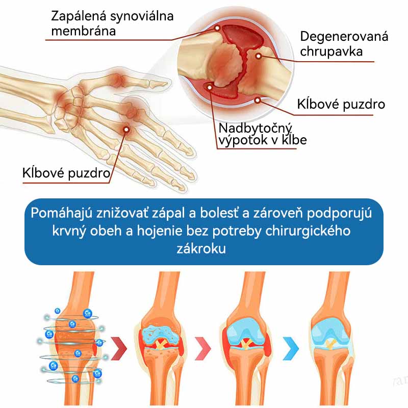 𝐎𝐟𝐢𝐜𝐢á𝐥𝐧𝐲 𝐨𝐛𝐜𝐡𝐨𝐝 | 👩‍⚕️🎁𝗣𝗶𝗰𝗱𝗼® 𝗕𝗣𝗖-𝟭𝟱𝟳 𝗞𝗿é𝗺 𝗻𝗮 𝗵𝗼𝗷𝗲𝗻𝗶𝗲 𝗸ĺ𝗯𝗼𝘃🦴Lieči artritídu, neuropatiu, reumu, športové zranenia a ďalšie ochorenia.👩‍⚕️