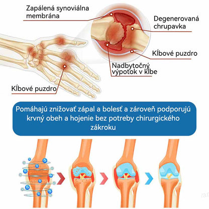 𝐎𝐟𝐢𝐜𝐢á𝐥𝐧𝐲 𝐨𝐛𝐜𝐡𝐨𝐝 | 👩‍⚕️🎁𝗣𝗶𝗰𝗱𝗼® 𝗕𝗣𝗖-𝟭𝟱𝟳 𝗞𝗿é𝗺 𝗻𝗮 𝗵𝗼𝗷𝗲𝗻𝗶𝗲 𝗸ĺ𝗯𝗼𝘃🦴Lieči artritídu, neuropatiu, reumu, športové zranenia a ďalšie ochorenia.👩‍⚕️