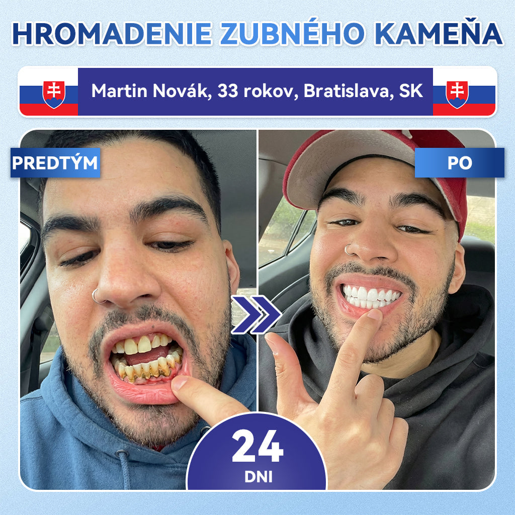 🦷𝐆𝐥𝐢𝐦𝐦𝐞𝐫𝐥𝐲® 𝐓𝐢𝐝𝐞𝐠𝐥𝐮𝐬𝐢𝐛 𝐙𝐮𝐛𝐲 𝐀 Ď𝐚𝐬𝐧á 𝐎𝐩𝐫𝐚𝐯𝐧á 𝐌𝐢𝐤𝐫𝐨𝐢𝐡𝐥𝐨𝐯á 𝐍á𝐩𝐥𝐚𝐬ť  |🌟🪥 𝐏𝐨𝐤𝐫𝐨č𝐢𝐥é 𝐩á𝐬𝐢𝐤𝐲 𝐧𝐚 𝐚𝐤𝐭𝐢𝐯á𝐜𝐢𝐮 𝐤𝐦𝐞ň𝐨𝐯ý𝐜𝐡 𝐛𝐮𝐧𝐢𝐞𝐤 𝐳𝐮𝐛𝐨𝐯(🦷𝐎𝐛𝐧𝐨𝐯𝐮𝐣𝐞 𝐙𝐮𝐛𝐧ú 𝐒𝐤𝐥𝐨𝐯𝐢𝐧𝐮 𝐀 𝐃𝐞𝐧𝐭í𝐧 • 𝐏𝐨𝐬𝐢𝐥ň𝐮𝐣𝐞 Ď𝐚𝐬𝐧á • 𝐎𝐝𝐬𝐭𝐫𝐚ň𝐮𝐣𝐞 𝐙𝐮𝐛𝐧ý 𝐊𝐚𝐦𝐞ň 𝐀 𝐙á𝐩𝐚𝐜𝐡 • 𝐙𝐚𝐬𝐭𝐚𝐯𝐮𝐣𝐞 𝐂𝐢𝐭𝐥𝐢𝐯𝐨𝐬ť 𝐙𝐮𝐛𝐨𝐯) (Copy)
