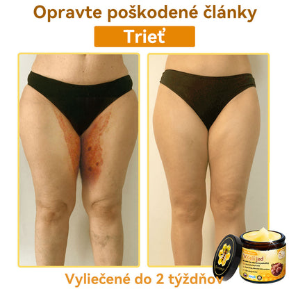 [💯 Bez bolesti-bez vedľajších účinkov] 𝐃𝐨𝐫𝐦𝐨𝐫𝐧𝐚®💥💥𝐕č𝐞𝐥í 𝐣𝐞𝐝 𝐊𝐫é𝐦 𝐧𝐚 𝐨𝐛𝐧𝐨𝐯𝐮 𝐩𝐨𝐤𝐨ž𝐤𝐲- POSLEDNÝ DEŇ 70% VYPNUTIE