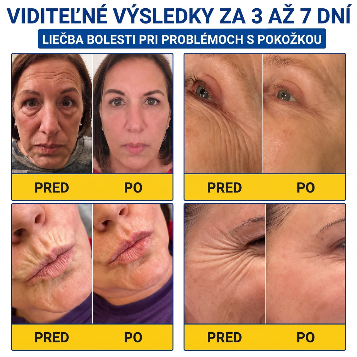 𝑮𝒂𝒇𝒂𝒄𝒆® 👨‍⚕️🌏 𝑃𝐷𝑅𝑁 𝐾𝑅É𝑀 𝑃𝑅𝑂𝑇𝐼 𝑉𝑅Á𝑆𝐾𝐴𝑀 𝐴 𝑁𝐴 𝑆𝑃𝐸𝑉𝑁𝐸𝑁𝐼𝐸 𝑃𝑂𝐾𝑂Ž𝐾𝑌