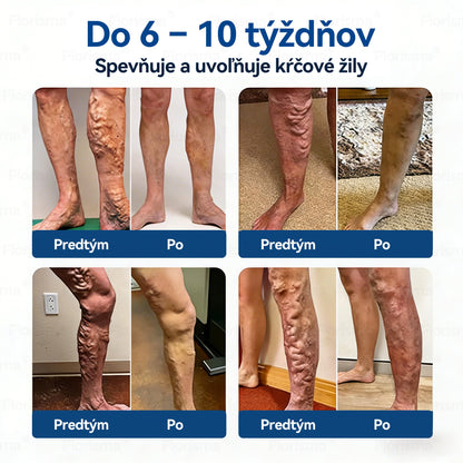 🛡️𝑭𝑳𝑶𝑹𝑰𝑺𝑴𝑨® 👩‍⚕️🍉𝑫𝒊𝒐𝒔𝒎í𝒏 𝒂 𝑯𝒆𝒔𝒑𝒆𝒓𝒊𝒅í𝒏 𝑴𝒊𝒌𝒓𝒐𝒊𝒉𝒍𝒐𝒗á 𝑵á𝒑𝒍𝒂𝒔ť 𝑺 𝑭𝒐𝒓𝒎𝒖𝒍𝒐𝒖 𝑲𝒍𝒊𝒏𝒊𝒄𝒌𝒆𝒋 𝑲𝒗𝒂𝒍𝒊𝒕𝒚 — 𝐏𝐨𝐤𝐫𝐨č𝐢𝐥á 𝐛𝐲𝐥𝐢𝐧𝐧á 𝐳𝐦𝐞𝐬 𝐳𝐚𝐦𝐞𝐫𝐚𝐧á 𝐧𝐚 𝐩𝐚𝐯úč𝐢𝐞 ž𝐢𝐥𝐲 𝐚 𝐳𝐦𝐢𝐞𝐫ň𝐮𝐣𝐞 𝐩𝐨𝐜𝐢𝐭 ť𝐚ž𝐤ý𝐜𝐡 𝐚 𝐮𝐧𝐚𝐯𝐞𝐧ý𝐜𝐡 𝐧ô𝐡