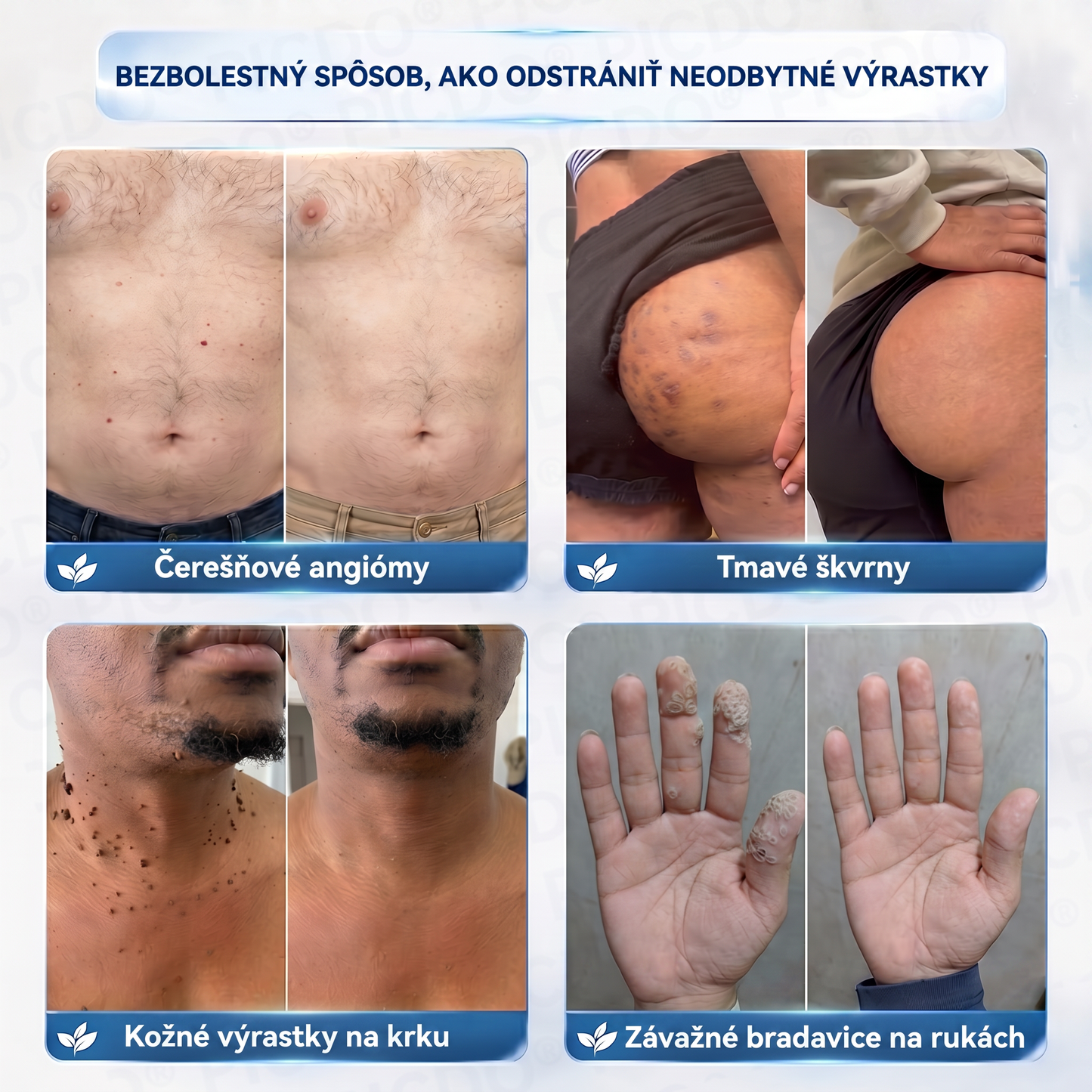🔥🔥𝐏𝐢𝐜𝐝𝐨® 7-𝑫ň𝒐𝒗ý 𝑲𝒓é𝒎 𝑵𝒂 𝑶𝒅𝒔𝒕𝒓𝒂𝒏𝒐𝒗𝒂𝒏𝒊𝒆𝒌𝒐ž𝒏ý𝒄𝒉 𝑽ý𝒓𝒂𝒔𝒕𝒌𝒐𝒗 𝑨 Š𝒌𝒗ř𝒏🩵 (Receptúra bez bolesti a bez jaziev) 💪