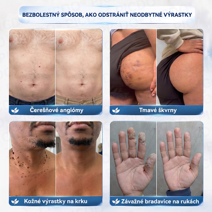 🔥🔥𝐏𝐢𝐜𝐝𝐨® 7-𝑫ň𝒐𝒗ý 𝑲𝒓é𝒎 𝑵𝒂 𝑶𝒅𝒔𝒕𝒓𝒂𝒏𝒐𝒗𝒂𝒏𝒊𝒆𝒌𝒐ž𝒏ý𝒄𝒉 𝑽ý𝒓𝒂𝒔𝒕𝒌𝒐𝒗 𝑨 Š𝒌𝒗ř𝒏🩵 (Receptúra bez bolesti a bez jaziev) 💪