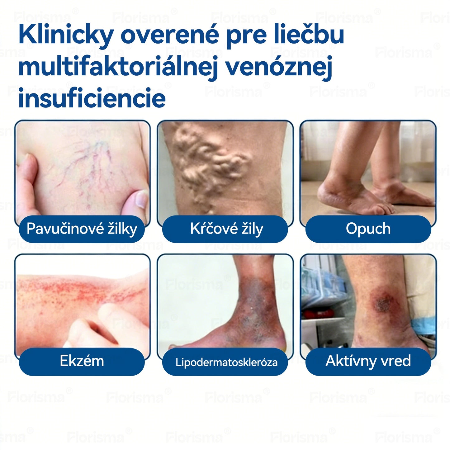 🛡️𝑭𝑳𝑶𝑹𝑰𝑺𝑴𝑨® 👩‍⚕️🍉𝑫𝒊𝒐𝒔𝒎í𝒏 𝒂 𝑯𝒆𝒔𝒑𝒆𝒓𝒊𝒅í𝒏 𝑴𝒊𝒌𝒓𝒐𝒊𝒉𝒍𝒐𝒗á 𝑵á𝒑𝒍𝒂𝒔ť 𝑺 𝑭𝒐𝒓𝒎𝒖𝒍𝒐𝒖 𝑲𝒍𝒊𝒏𝒊𝒄𝒌𝒆𝒋 𝑲𝒗𝒂𝒍𝒊𝒕𝒚 — 𝐏𝐨𝐤𝐫𝐨č𝐢𝐥á 𝐛𝐲𝐥𝐢𝐧𝐧á 𝐳𝐦𝐞𝐬 𝐳𝐚𝐦𝐞𝐫𝐚𝐧á 𝐧𝐚 𝐩𝐚𝐯úč𝐢𝐞 ž𝐢𝐥𝐲 𝐚 𝐳𝐦𝐢𝐞𝐫ň𝐮𝐣𝐞 𝐩𝐨𝐜𝐢𝐭 ť𝐚ž𝐤ý𝐜𝐡 𝐚 𝐮𝐧𝐚𝐯𝐞𝐧ý𝐜𝐡 𝐧ô𝐡