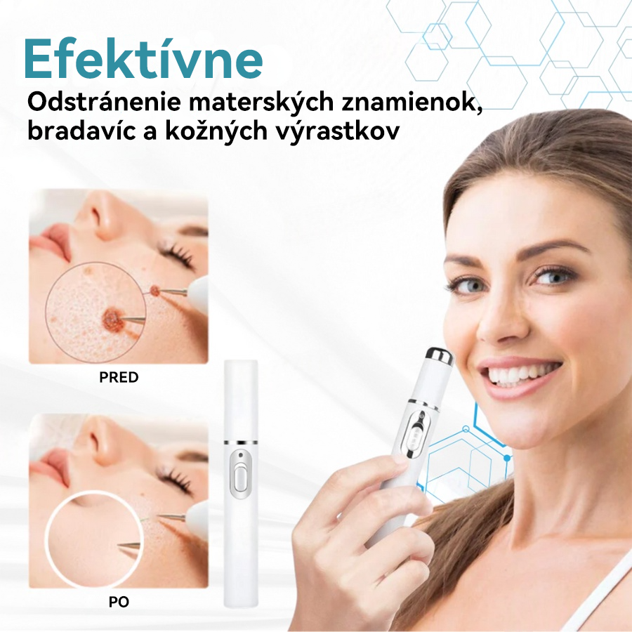 𝐉𝐚𝐬𝐬𝐞𝐞𝐦® Laserové pero medicínskej kvality 💕 (Poháňané CO₂ laserovou technológiou – účinne odstraňuje znamienka, bradavice, kožné výrastky, pigmentové škvrny a iné nedokonalosti pokožky) 🔥