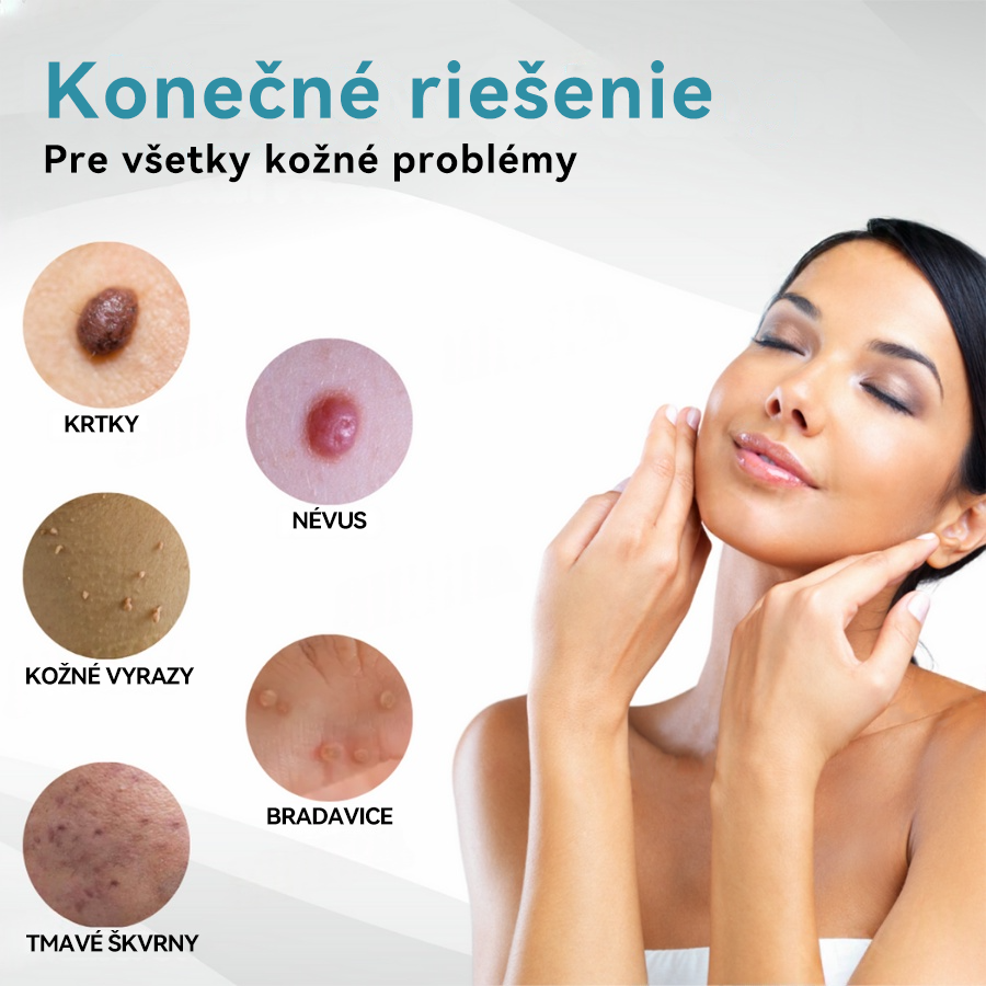 𝐉𝐚𝐬𝐬𝐞𝐞𝐦® Laserové pero medicínskej kvality 💕 (Poháňané CO₂ laserovou technológiou – účinne odstraňuje znamienka, bradavice, kožné výrastky, pigmentové škvrny a iné nedokonalosti pokožky) 🔥