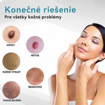 𝐉𝐚𝐬𝐬𝐞𝐞𝐦® Laserové pero medicínskej kvality 💕 (Poháňané CO₂ laserovou technológiou – účinne odstraňuje znamienka, bradavice, kožné výrastky, pigmentové škvrny a iné nedokonalosti pokožky) 🔥