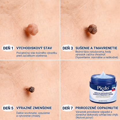 🔥🔥𝐏𝐢𝐜𝐝𝐨® 7-𝑫ň𝒐𝒗ý 𝑲𝒓é𝒎 𝑵𝒂 𝑶𝒅𝒔𝒕𝒓𝒂𝒏𝒐𝒗𝒂𝒏𝒊𝒆𝒌𝒐ž𝒏ý𝒄𝒉 𝑽ý𝒓𝒂𝒔𝒕𝒌𝒐𝒗 𝑨 Š𝒌𝒗ř𝒏🩵 (Receptúra bez bolesti a bez jaziev) 💪