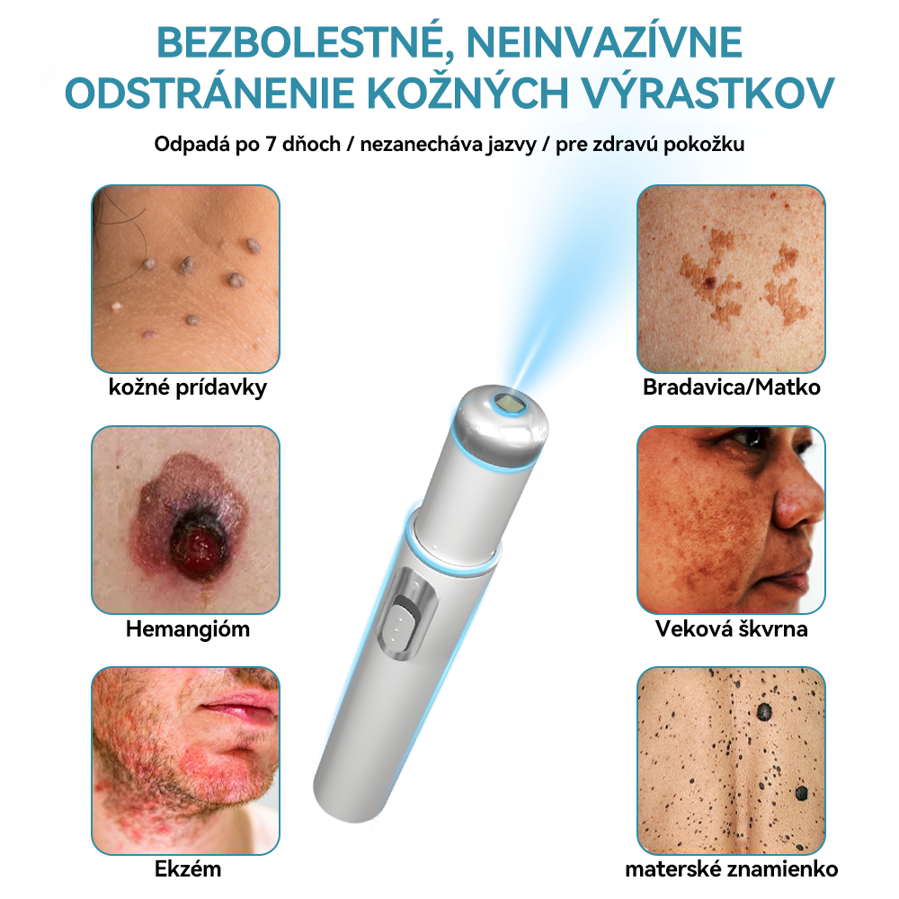 𝐉𝐚𝐬𝐬𝐞𝐞𝐦® Laserové pero medicínskej kvality 💕 (Poháňané CO₂ laserovou technológiou – účinne odstraňuje znamienka, bradavice, kožné výrastky, pigmentové škvrny a iné nedokonalosti pokožky) 🔥
