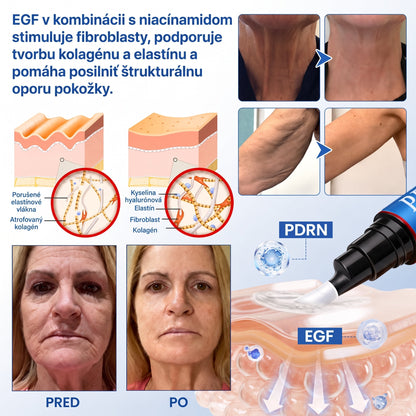 𝑮𝒂𝒇𝒂𝒄𝒆® 👨‍⚕️🌏 𝑃𝐷𝑅𝑁 𝐾𝑅É𝑀 𝑃𝑅𝑂𝑇𝐼 𝑉𝑅Á𝑆𝐾𝐴𝑀 𝐴 𝑁𝐴 𝑆𝑃𝐸𝑉𝑁𝐸𝑁𝐼𝐸 𝑃𝑂𝐾𝑂Ž𝐾𝑌