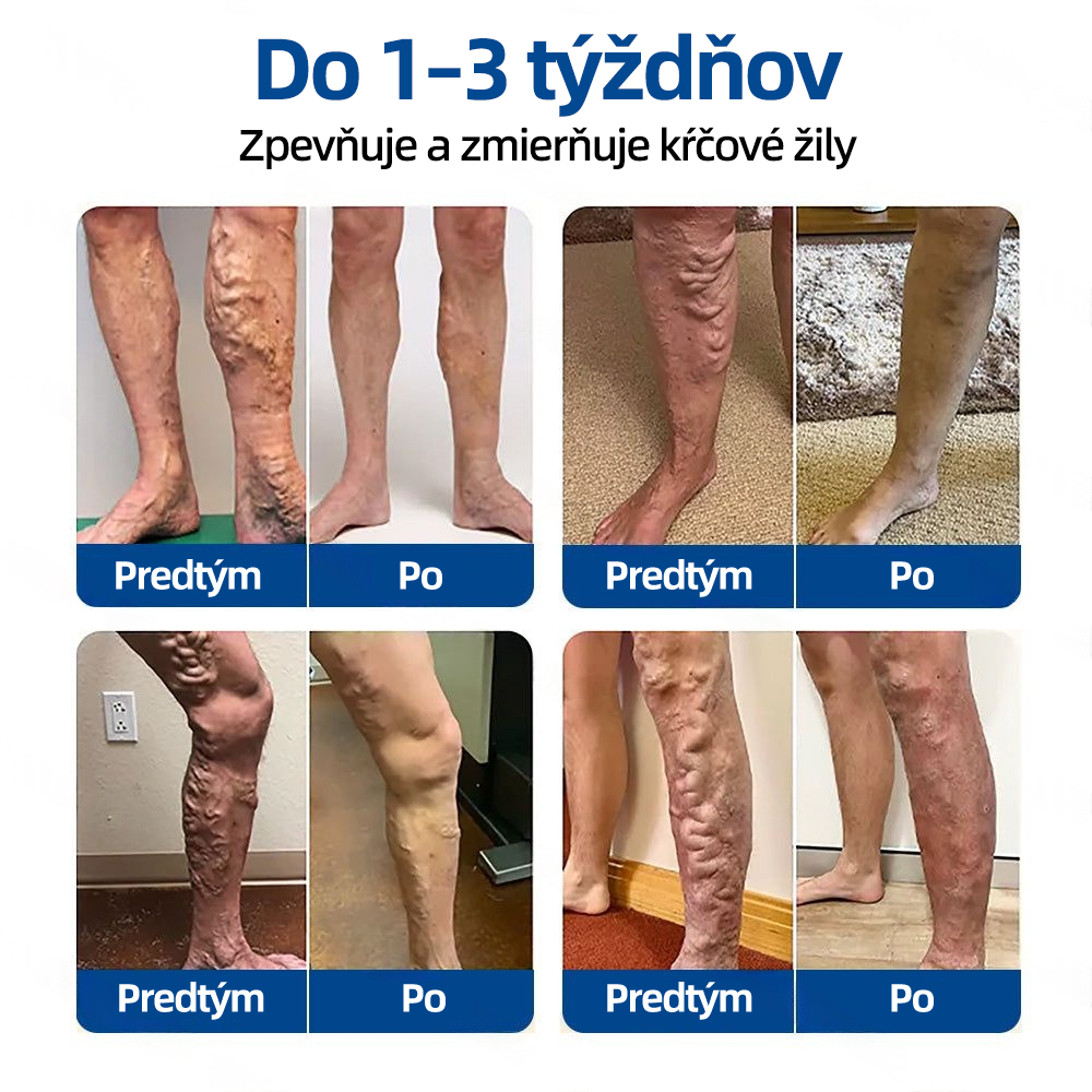 ✅ Florisma®🌿 💖 Trvalá hydratácia ⚡ Okamžitá úľava, dlhodobý účinok