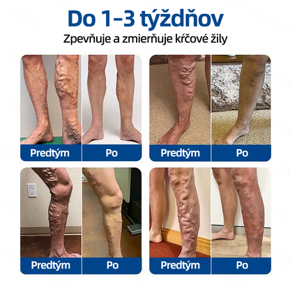 ✅ Florisma®🌿 💖 Trvalá hydratácia ⚡ Okamžitá úľava, dlhodobý účinok