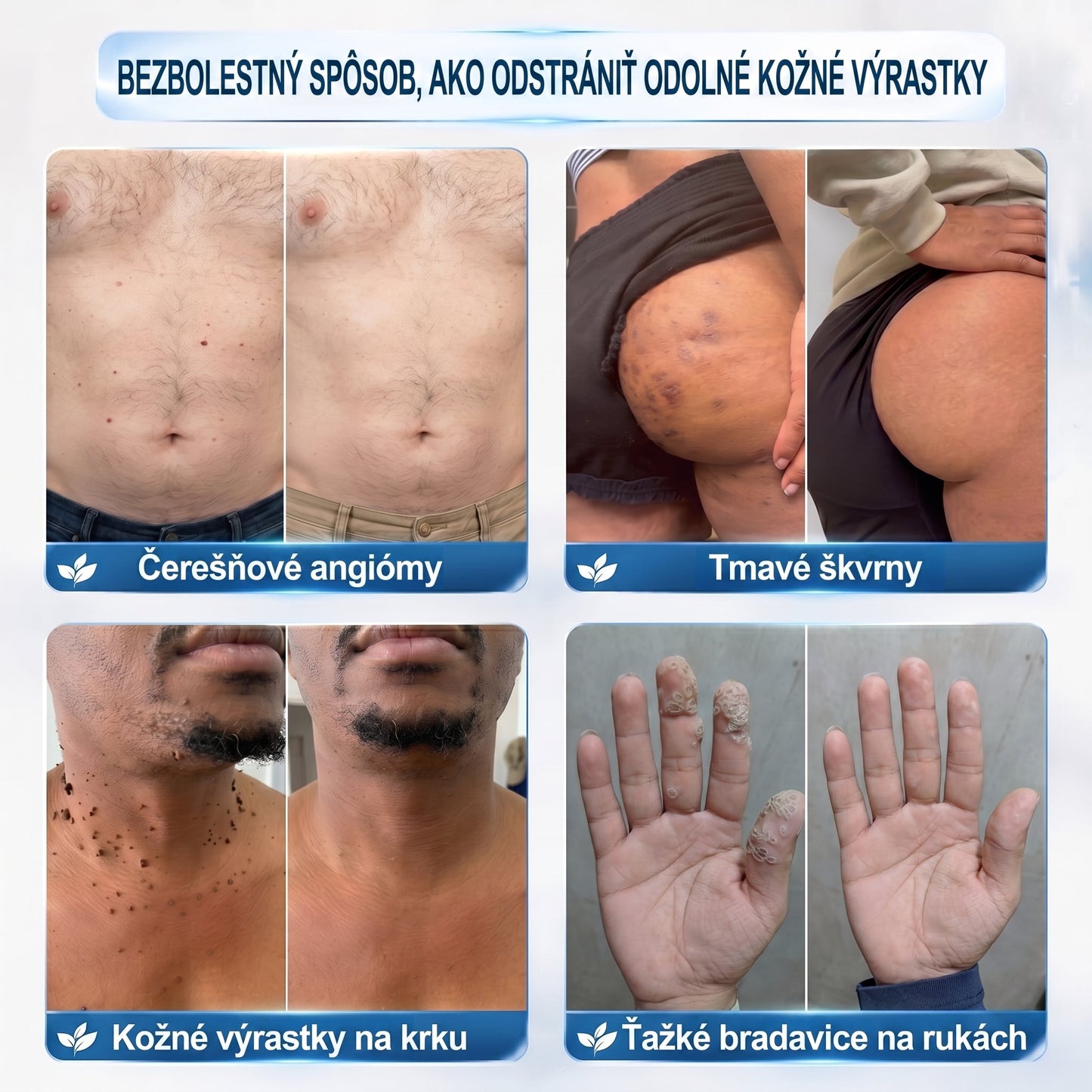 🐣🐣𝐏𝒊𝐜𝐝𝒐® 7-𝑫ň𝒐𝒗ý 𝑵𝒂 𝑶𝒅𝒔𝒕𝒓𝒂ň𝒐𝒗𝒂𝒏𝒊𝒆 𝑷𝒊𝒈𝒎𝒆𝒏𝒕𝒐𝒗ý𝒄𝒉 Š𝒌𝒗ŕ𝒏 𝑨 𝑱𝒂𝒛𝒊𝒆𝒗 𝑷𝒆𝒓𝒐(𝐵𝑒𝑧 𝑏𝑜𝑙𝑒𝑠𝑡𝑖, 𝑏𝑒𝑧 𝑗𝑎𝑧𝑖𝑒𝑣 – 𝑟𝑜𝑙𝑙𝑒𝑟𝑏𝑎𝑙𝑙)💪