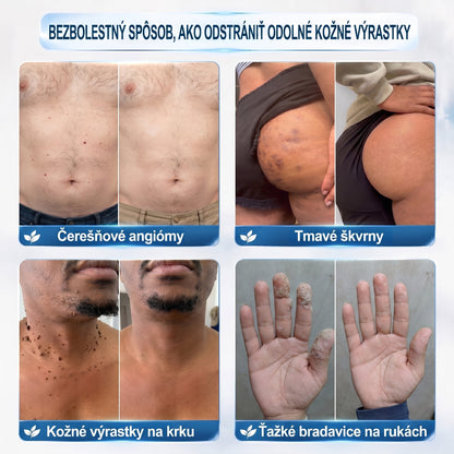 🐣🐣𝐏𝒊𝐜𝐝𝒐® 7-𝑫ň𝒐𝒗ý 𝑵𝒂 𝑶𝒅𝒔𝒕𝒓𝒂ň𝒐𝒗𝒂𝒏𝒊𝒆 𝑷𝒊𝒈𝒎𝒆𝒏𝒕𝒐𝒗ý𝒄𝒉 Š𝒌𝒗ŕ𝒏 𝑨 𝑱𝒂𝒛𝒊𝒆𝒗 𝑷𝒆𝒓𝒐(𝐵𝑒𝑧 𝑏𝑜𝑙𝑒𝑠𝑡𝑖, 𝑏𝑒𝑧 𝑗𝑎𝑧𝑖𝑒𝑣 – 𝑟𝑜𝑙𝑙𝑒𝑟𝑏𝑎𝑙𝑙)💪