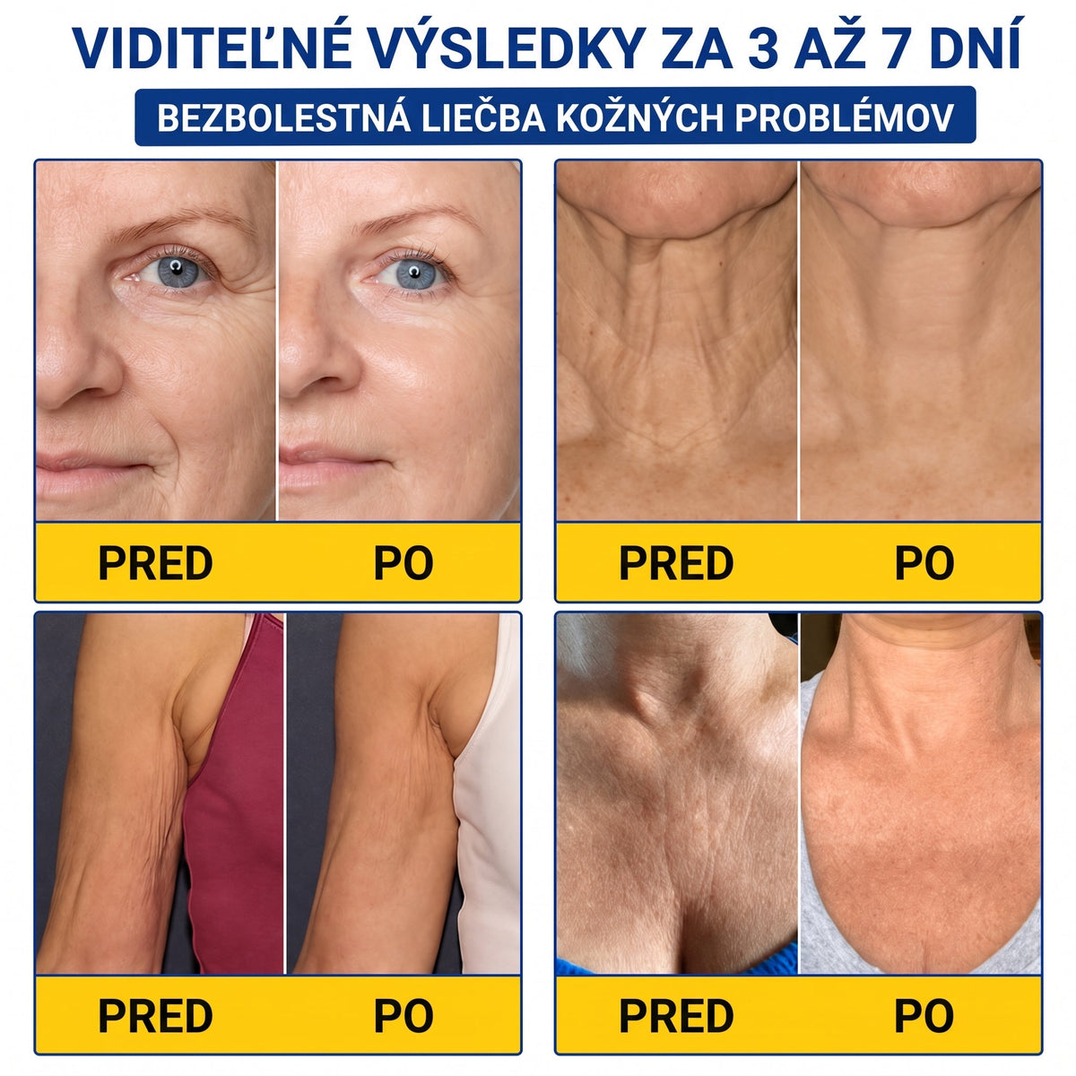 𝑮𝒂𝒇𝒂𝒄𝒆® 👨‍⚕️🌏 𝑃𝐷𝑅𝑁 𝐾𝑅É𝑀 𝑃𝑅𝑂𝑇𝐼 𝑉𝑅Á𝑆𝐾𝐴𝑀 𝐴 𝑁𝐴 𝑆𝑃𝐸𝑉𝑁𝐸𝑁𝐼𝐸 𝑃𝑂𝐾𝑂Ž𝐾𝑌