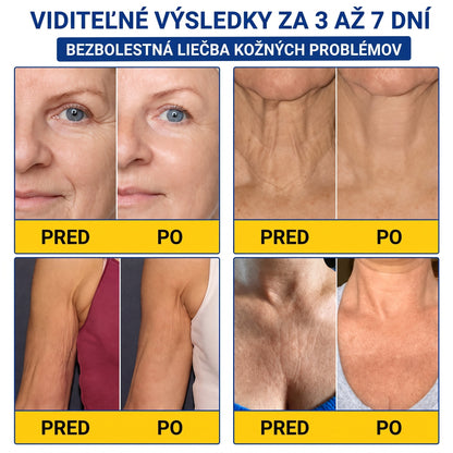 𝑮𝒂𝒇𝒂𝒄𝒆® 👨‍⚕️🌏 𝑃𝐷𝑅𝑁 𝐾𝑅É𝑀 𝑃𝑅𝑂𝑇𝐼 𝑉𝑅Á𝑆𝐾𝐴𝑀 𝐴 𝑁𝐴 𝑆𝑃𝐸𝑉𝑁𝐸𝑁𝐼𝐸 𝑃𝑂𝐾𝑂Ž𝐾𝑌