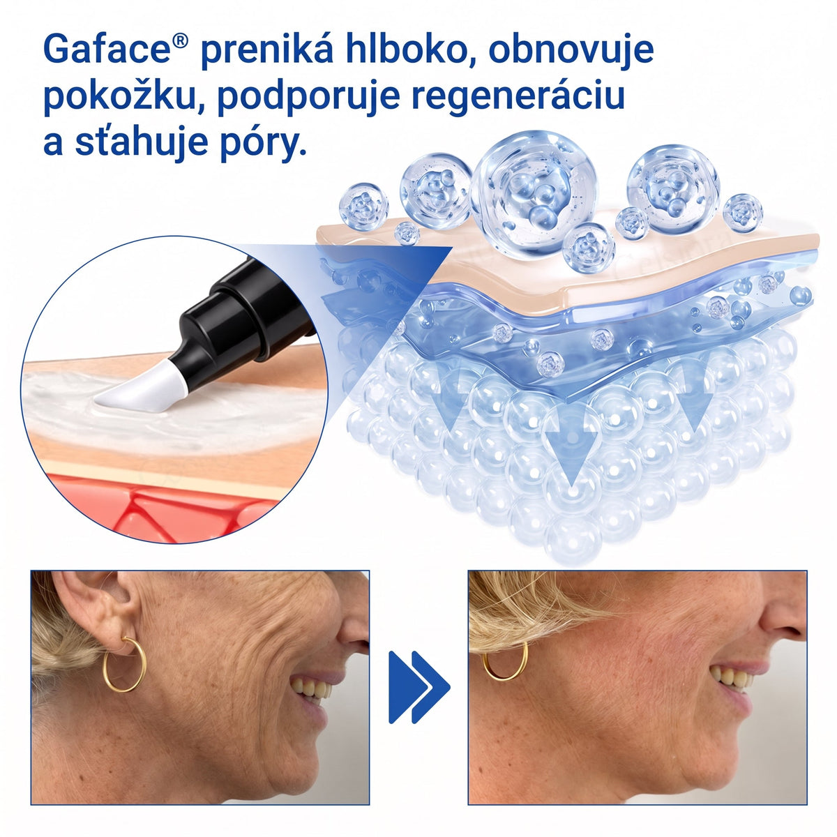 𝑮𝒂𝒇𝒂𝒄𝒆® 👨‍⚕️🌏 𝑃𝐷𝑅𝑁 𝐾𝑅É𝑀 𝑃𝑅𝑂𝑇𝐼 𝑉𝑅Á𝑆𝐾𝐴𝑀 𝐴 𝑁𝐴 𝑆𝑃𝐸𝑉𝑁𝐸𝑁𝐼𝐸 𝑃𝑂𝐾𝑂Ž𝐾𝑌