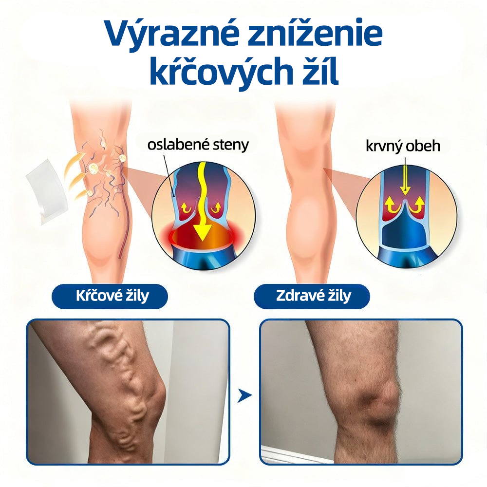 ✅ Florisma®🌿 💖 Trvalá hydratácia ⚡ Okamžitá úľava, dlhodobý účinok