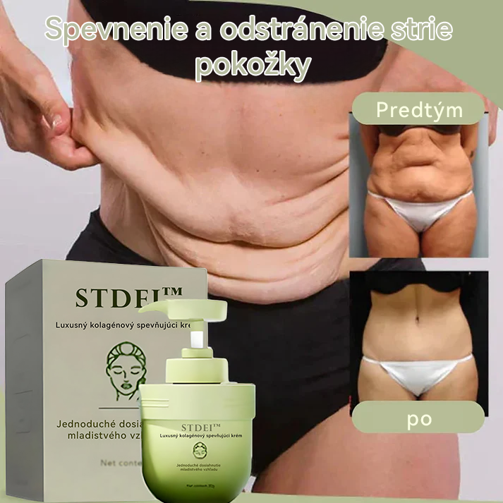 STDEI™ 💕💕 Luxusný kolagénový krém na pevnosť (návrat k mladistvej pleti)✨