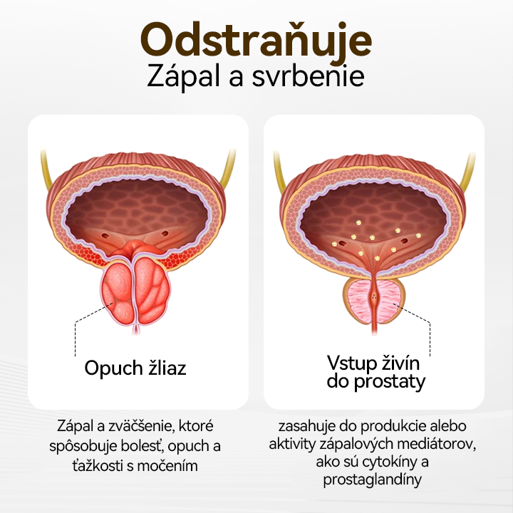 CZTICLE™ 🍀ProstaVibe Inhalátor zdravia včiel