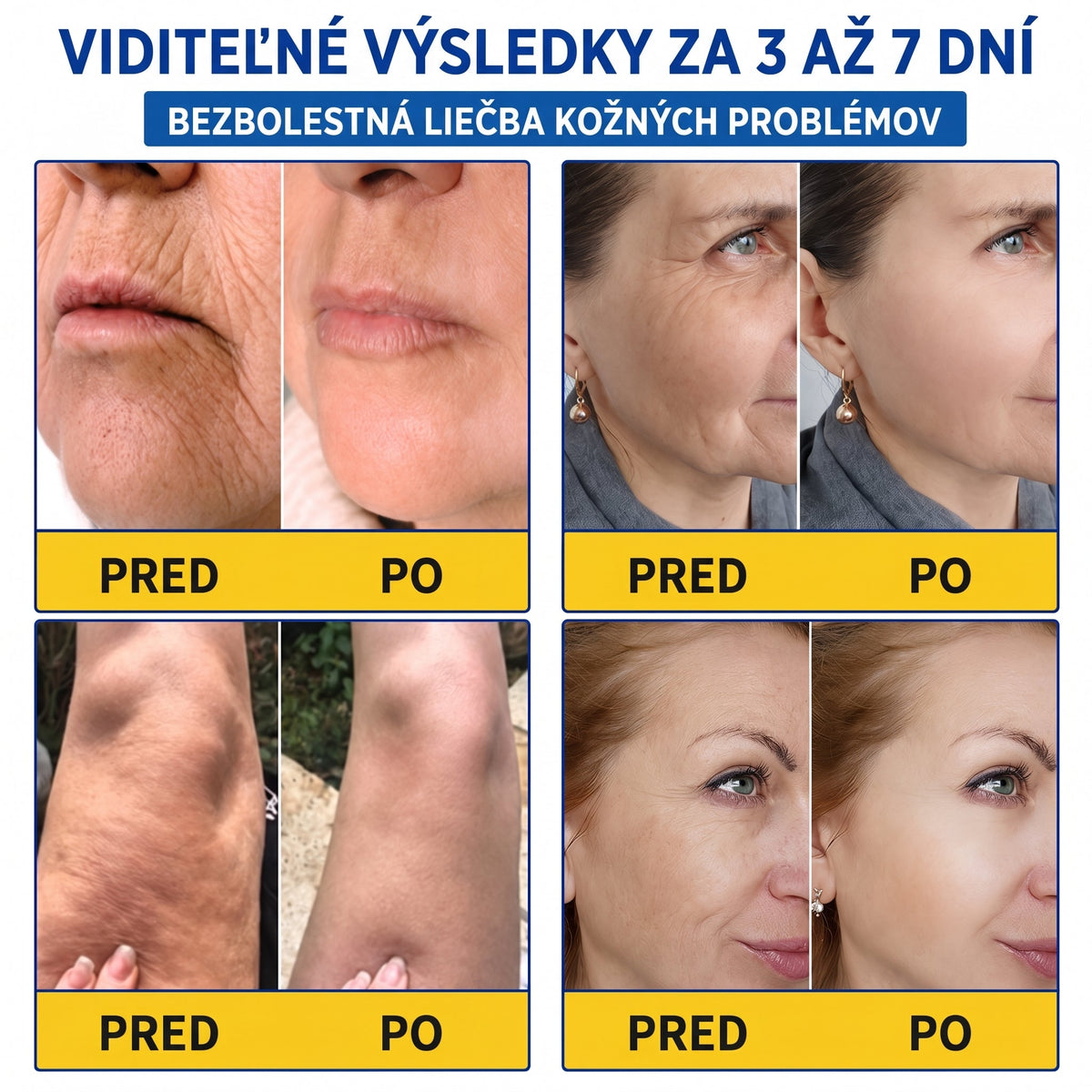 𝑮𝒂𝒇𝒂𝒄𝒆® 👨‍⚕️🌏 𝑃𝐷𝑅𝑁 𝐾𝑅É𝑀 𝑃𝑅𝑂𝑇𝐼 𝑉𝑅Á𝑆𝐾𝐴𝑀 𝐴 𝑁𝐴 𝑆𝑃𝐸𝑉𝑁𝐸𝑁𝐼𝐸 𝑃𝑂𝐾𝑂Ž𝐾𝑌