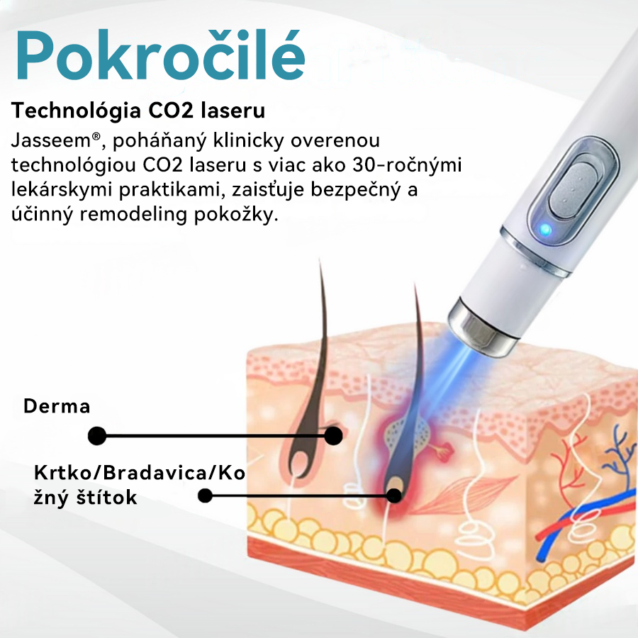 𝐉𝐚𝐬𝐬𝐞𝐞𝐦® Laserové pero medicínskej kvality 💕 (Poháňané CO₂ laserovou technológiou – účinne odstraňuje znamienka, bradavice, kožné výrastky, pigmentové škvrny a iné nedokonalosti pokožky) 🔥
