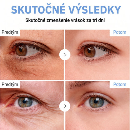 𝑮𝒂𝒇𝒂𝒄𝒆® 👨‍⚕️🌏 𝑃𝐷𝑅𝑁 𝐾𝑅É𝑀 𝑃𝑅𝑂𝑇𝐼 𝑉𝑅Á𝑆𝐾𝐴𝑀 𝐴 𝑁𝐴 𝑆𝑃𝐸𝑉𝑁𝐸𝑁𝐼𝐸 𝑃𝑂𝐾𝑂Ž𝐾𝑌