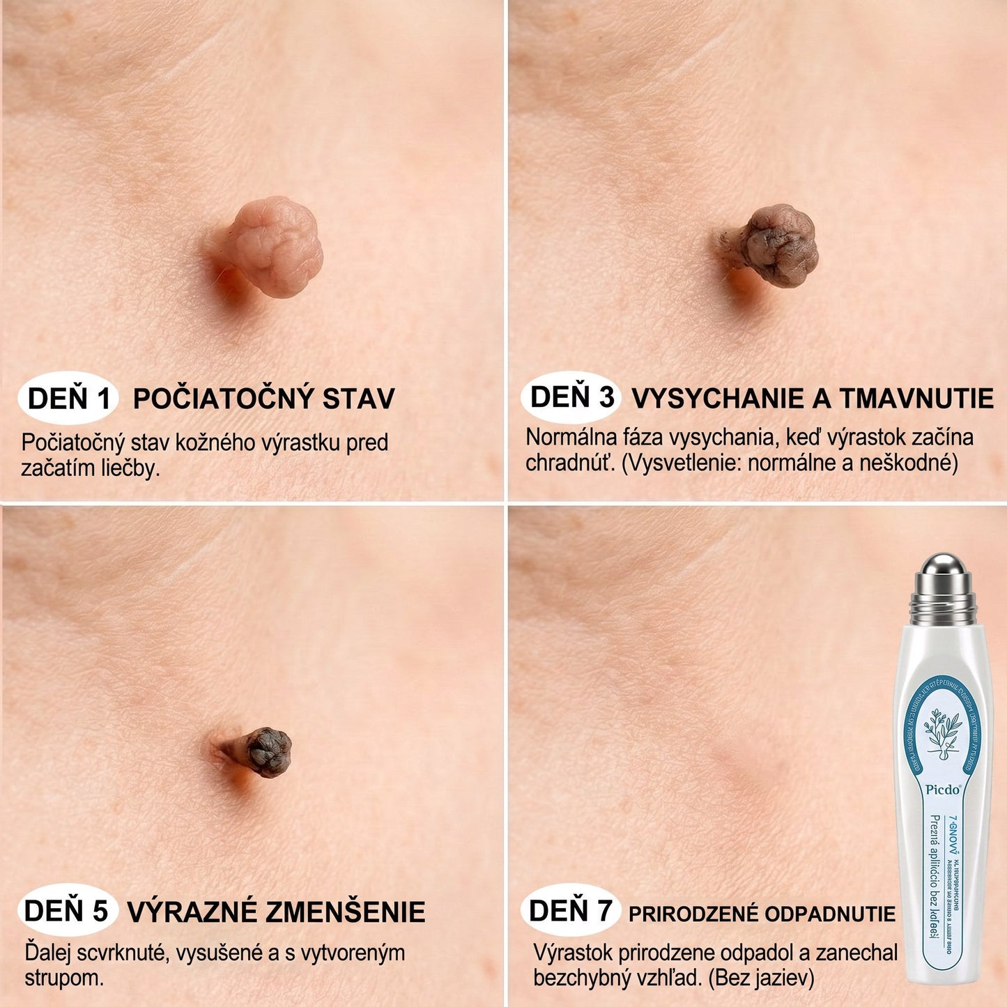 🐣🐣𝐏𝒊𝐜𝐝𝒐® 7-𝑫ň𝒐𝒗ý 𝑵𝒂 𝑶𝒅𝒔𝒕𝒓𝒂ň𝒐𝒗𝒂𝒏𝒊𝒆 𝑷𝒊𝒈𝒎𝒆𝒏𝒕𝒐𝒗ý𝒄𝒉 Š𝒌𝒗ŕ𝒏 𝑨 𝑱𝒂𝒛𝒊𝒆𝒗 𝑷𝒆𝒓𝒐(𝐵𝑒𝑧 𝑏𝑜𝑙𝑒𝑠𝑡𝑖, 𝑏𝑒𝑧 𝑗𝑎𝑧𝑖𝑒𝑣 – 𝑟𝑜𝑙𝑙𝑒𝑟𝑏𝑎𝑙𝑙)💪