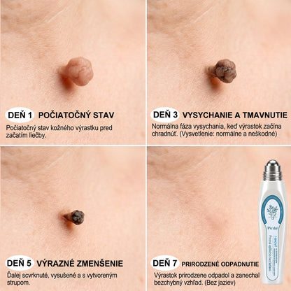 🐣🐣𝐏𝒊𝐜𝐝𝒐® 7-𝑫ň𝒐𝒗ý 𝑵𝒂 𝑶𝒅𝒔𝒕𝒓𝒂ň𝒐𝒗𝒂𝒏𝒊𝒆 𝑷𝒊𝒈𝒎𝒆𝒏𝒕𝒐𝒗ý𝒄𝒉 Š𝒌𝒗ŕ𝒏 𝑨 𝑱𝒂𝒛𝒊𝒆𝒗 𝑷𝒆𝒓𝒐(𝐵𝑒𝑧 𝑏𝑜𝑙𝑒𝑠𝑡𝑖, 𝑏𝑒𝑧 𝑗𝑎𝑧𝑖𝑒𝑣 – 𝑟𝑜𝑙𝑙𝑒𝑟𝑏𝑎𝑙𝑙)💪