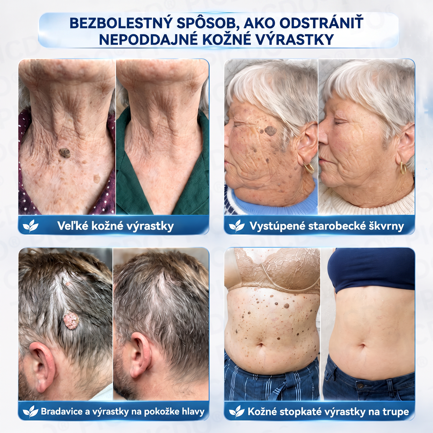 🔥🔥𝐏𝐢𝐜𝐝𝐨® 7-𝑫ň𝒐𝒗ý 𝑲𝒓é𝒎 𝑵𝒂 𝑶𝒅𝒔𝒕𝒓𝒂𝒏𝒐𝒗𝒂𝒏𝒊𝒆𝒌𝒐ž𝒏ý𝒄𝒉 𝑽ý𝒓𝒂𝒔𝒕𝒌𝒐𝒗 𝑨 Š𝒌𝒗ř𝒏🩵 (Receptúra bez bolesti a bez jaziev) 💪