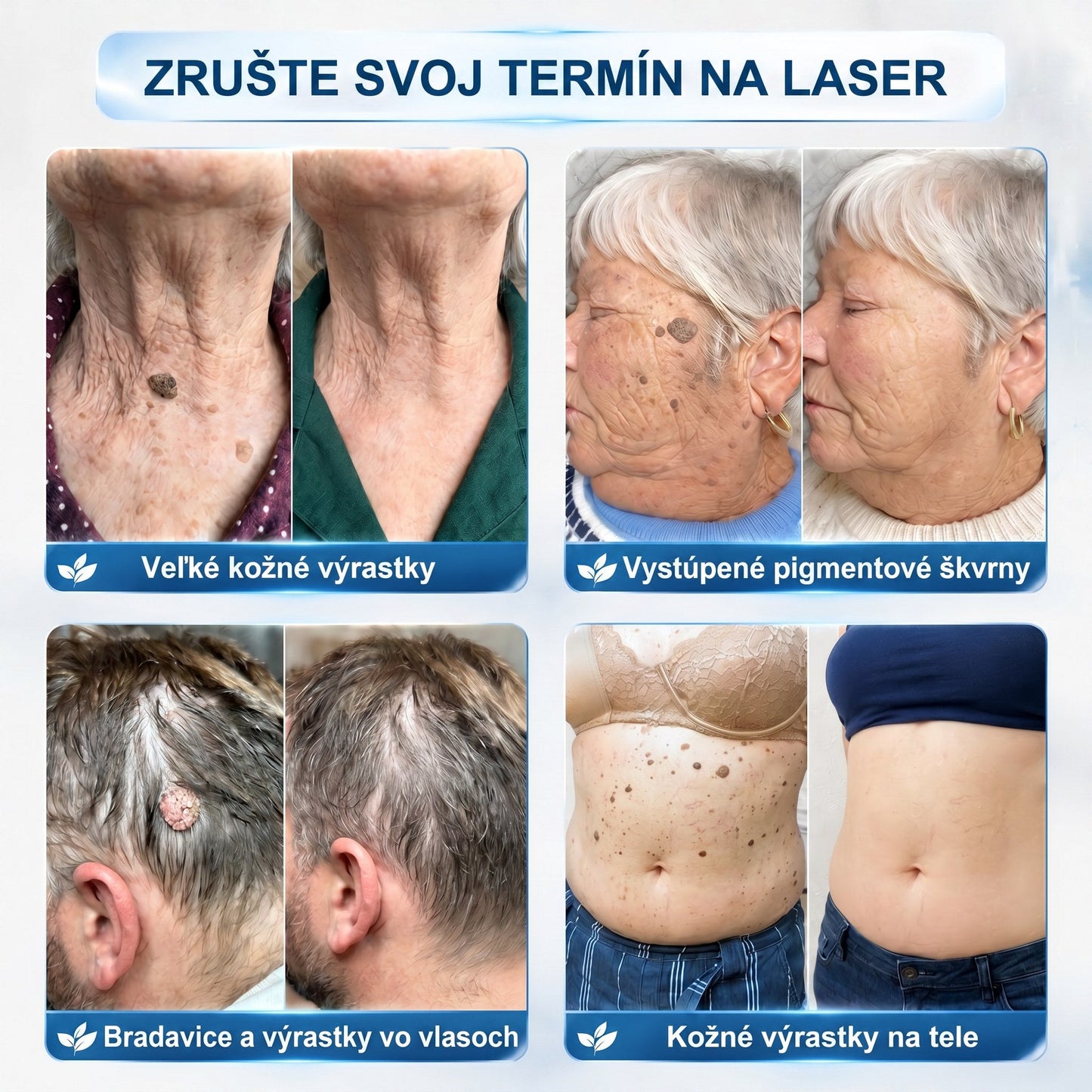 🐣🐣𝐏𝒊𝐜𝐝𝒐® 7-𝑫ň𝒐𝒗ý 𝑵𝒂 𝑶𝒅𝒔𝒕𝒓𝒂ň𝒐𝒗𝒂𝒏𝒊𝒆 𝑷𝒊𝒈𝒎𝒆𝒏𝒕𝒐𝒗ý𝒄𝒉 Š𝒌𝒗ŕ𝒏 𝑨 𝑱𝒂𝒛𝒊𝒆𝒗 𝑷𝒆𝒓𝒐(𝐵𝑒𝑧 𝑏𝑜𝑙𝑒𝑠𝑡𝑖, 𝑏𝑒𝑧 𝑗𝑎𝑧𝑖𝑒𝑣 – 𝑟𝑜𝑙𝑙𝑒𝑟𝑏𝑎𝑙𝑙)💪